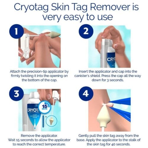 Cryotag Skin Tag Remover - 80ml