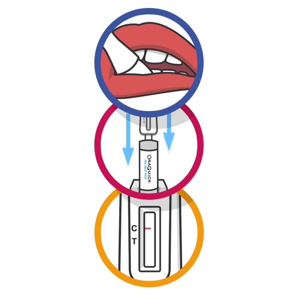 OraQuick HIV Self Test