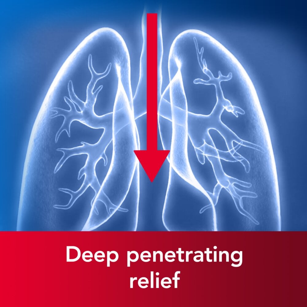 Benylin Chesty Coughs Non-Drowsy - 150ml