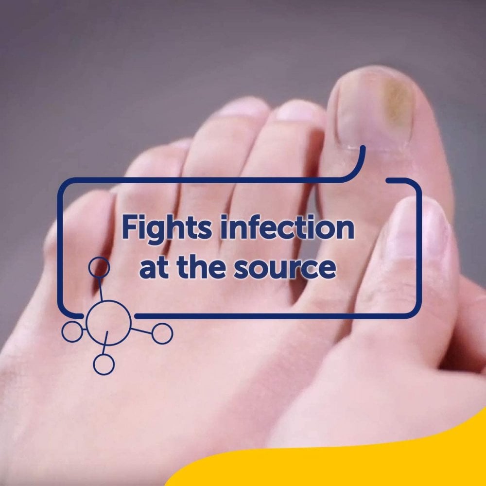 Scholl Fungal Nail Treatment - 3.8ml