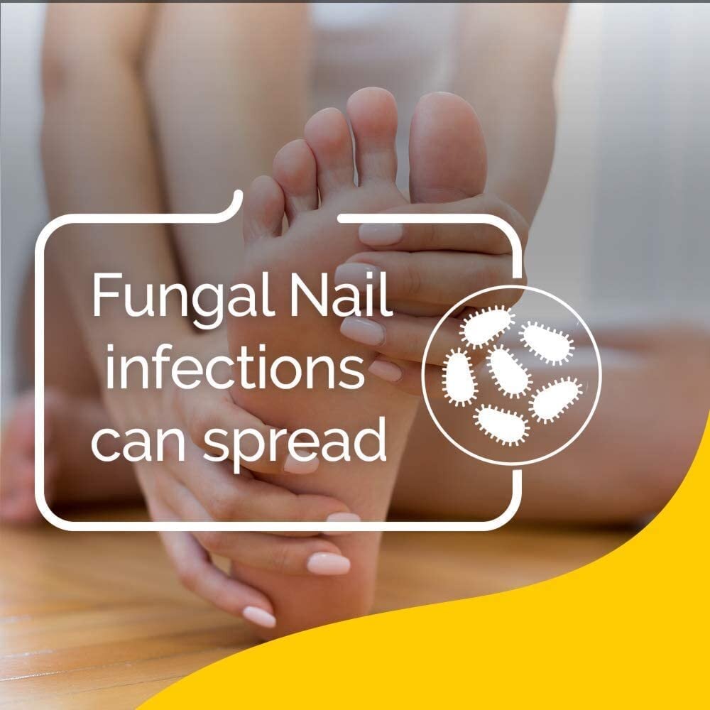 Schollmed Fungal Nail Treatment 5% - 2.5ml