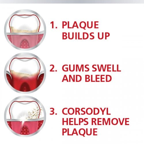 Corsodyl Alcohol-Free Treatment Mouthwash - 300ml